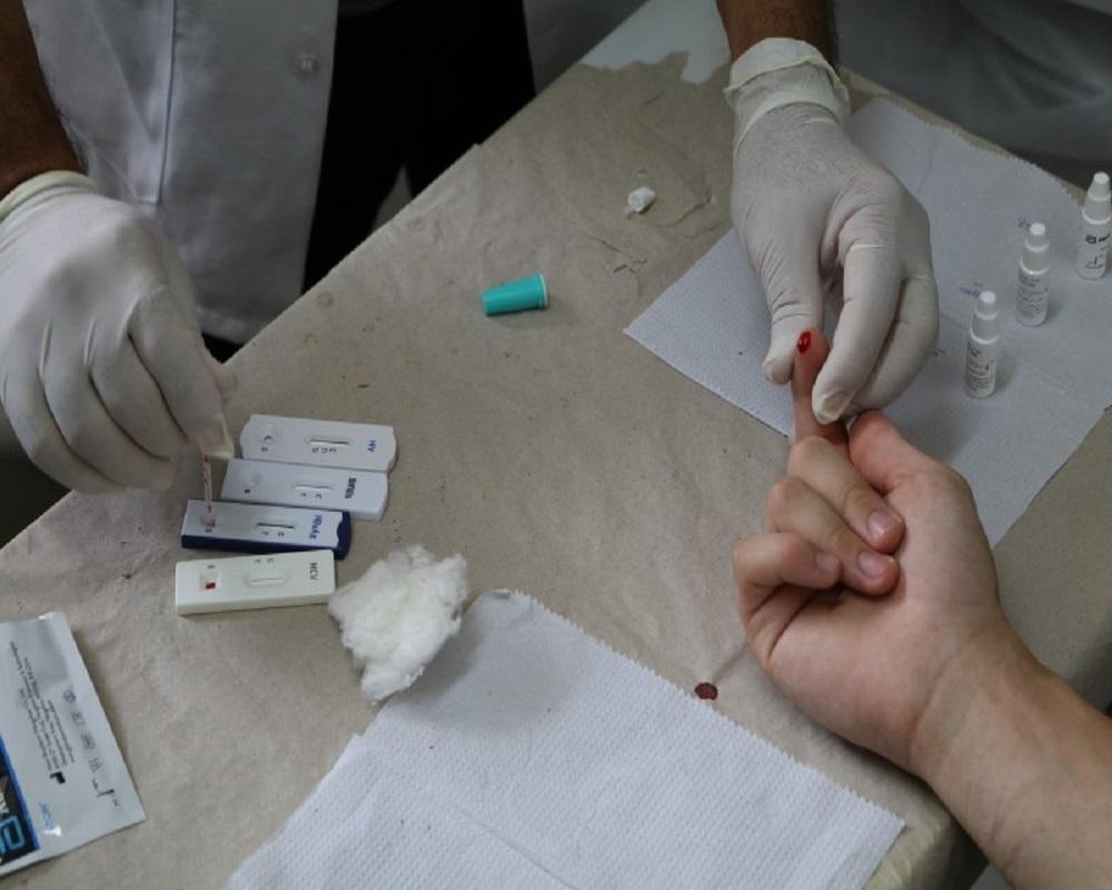 Prefeitura divulga boletim epidemiológico anual de HIV